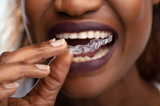 Protège dent nuit gouttière transparente anti-bruxisme nocturne insérée dans la bouche pour protéger les dents pendant le sommeil